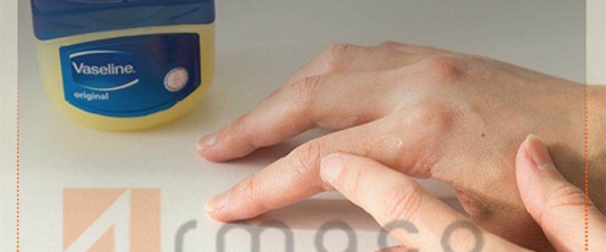 خواص وازلین برای لک صورت